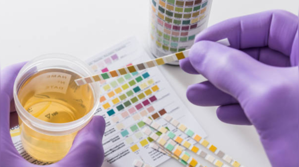 Uric acid: Here's what you don't know about it