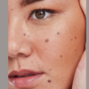 Moles that won’t sit still