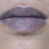 Pale or bluish skin