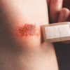 Wounds that refuse to heal