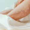 Sudden hair loss on legs