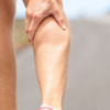 Burning sensation in the calves