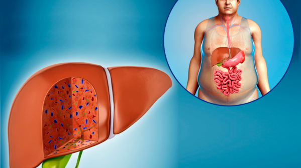 Fatty liver reversal: 5 signs the liver is healing