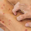 Itchy, tender, or painful spots