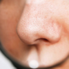 Ultimate lazy girl hacks to keep blackheads away