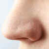 How to avoid blackheads?