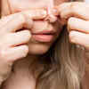 Blackheads are not harmless always