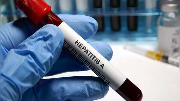 What is hepatitis A