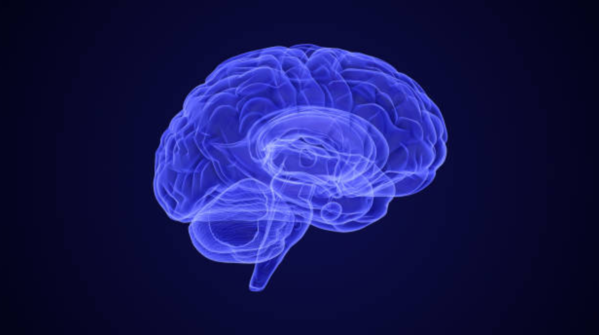 What is a stroke?