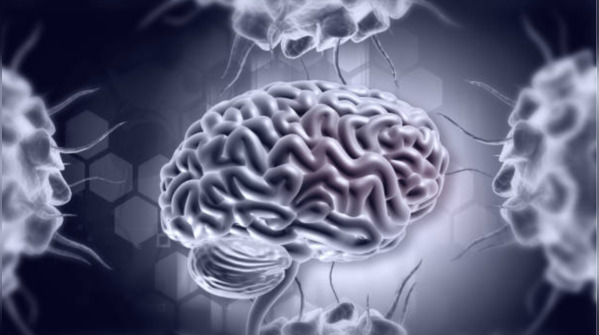 Stroke can strike at any age