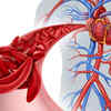 Iron deficiency & anemia