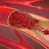 Doctor advises attention to the arteries