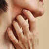 Skin or oral changes