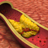 Brain cholesterol