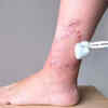 More frequent illnesses, weak immunity, and difficulty healing wounds