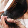 Hair loss, skin, and nail issues