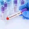 How is it diagnosed?