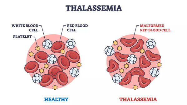 What is Alpha Thalassemia?
