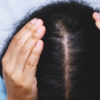 Washing hair too much or sleeping with wet hair 