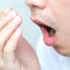 Foul breath