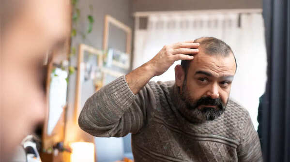 Baldness, a risk factor?