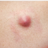 Unusual lumps or swelling