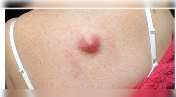 Unusual lumps or swelling