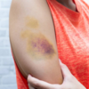 Unexplained pain