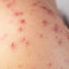 Red spots on skin