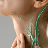 Swollen lymph nodes