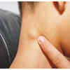 Swollen lymph nodes