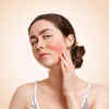 ​Redness and irritation