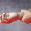 Severe hand pain (sudden onset)
