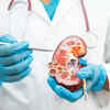 Myth 3: Long-term creatine use leads to kidney problems