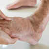 Slow-healing sores or frequent infections