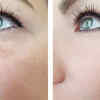 Bye bye dark spots