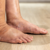 Swelling, particularly ankles and feet