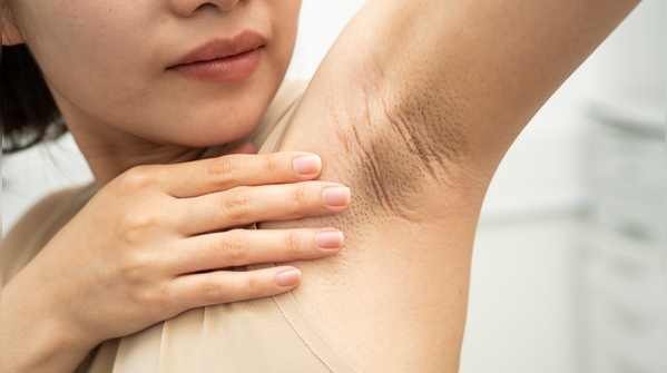 Redness or skin texture changes under the arm