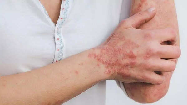 Skin, inflammatory, and hygiene concerns