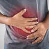 Who should get a colonoscopy?