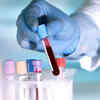 Why this blood test could be a game-changer