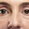 "Puffy face or water retention"