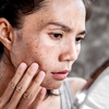 Fatigued and dull skin