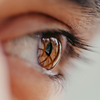 Vision changes