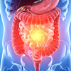 Digestion doesn’t always agree