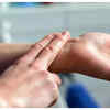 Dupuytren’s Contracture