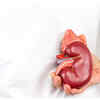 Keep your kidneys healthy
