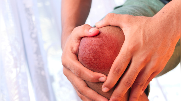Symptoms of high uric acid