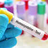 Homocysteine