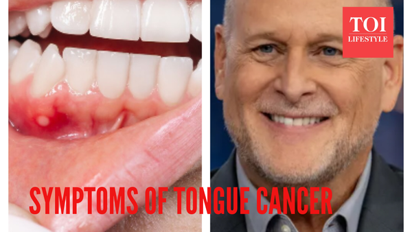 Dave Coulier Images